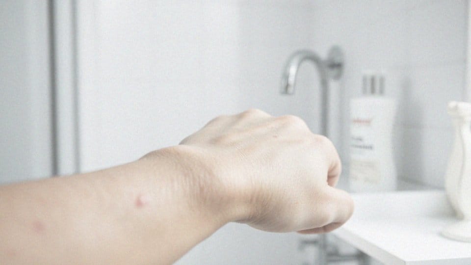 Jakie dolegliwości skórne towarzyszą łuszczycy?