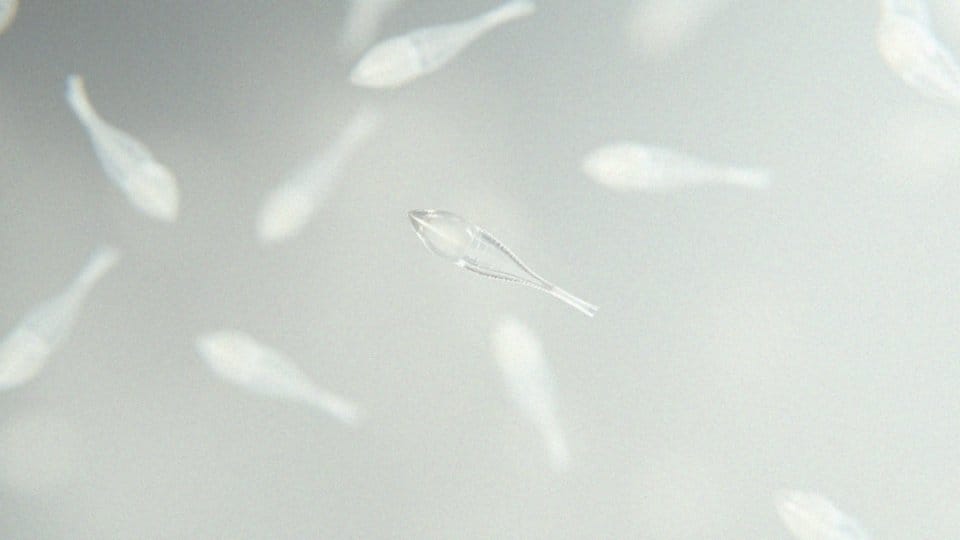 Ile żyje plemnik? Czas przeżycia w różnych warunkach