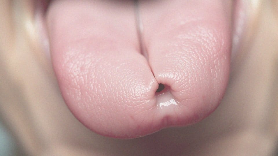 Zmiany pod językiem – co mogą oznaczać dla zdrowia?